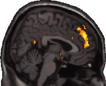 Human brain activity when thinking about others’ mental states